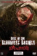 Watch TNA Wrestling: Best of the Bloodiest Brawls - Scars and Stitches Movie2k